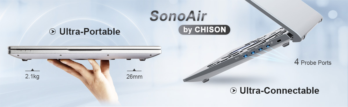 CHISON SonoAir: El sistema de ultrasonido portátil definitivo para diagnósticos seguros y diagnósticos confiables.