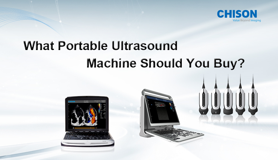 What Portable Ultrasound Machine Should You Buy?