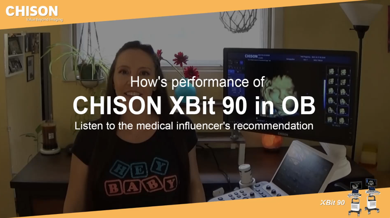 El rendimiento de CHISON XBit 90 en Obstetricia.