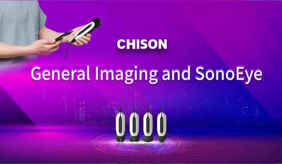 Discover A New World in General Imaging by CHISON SonoEye