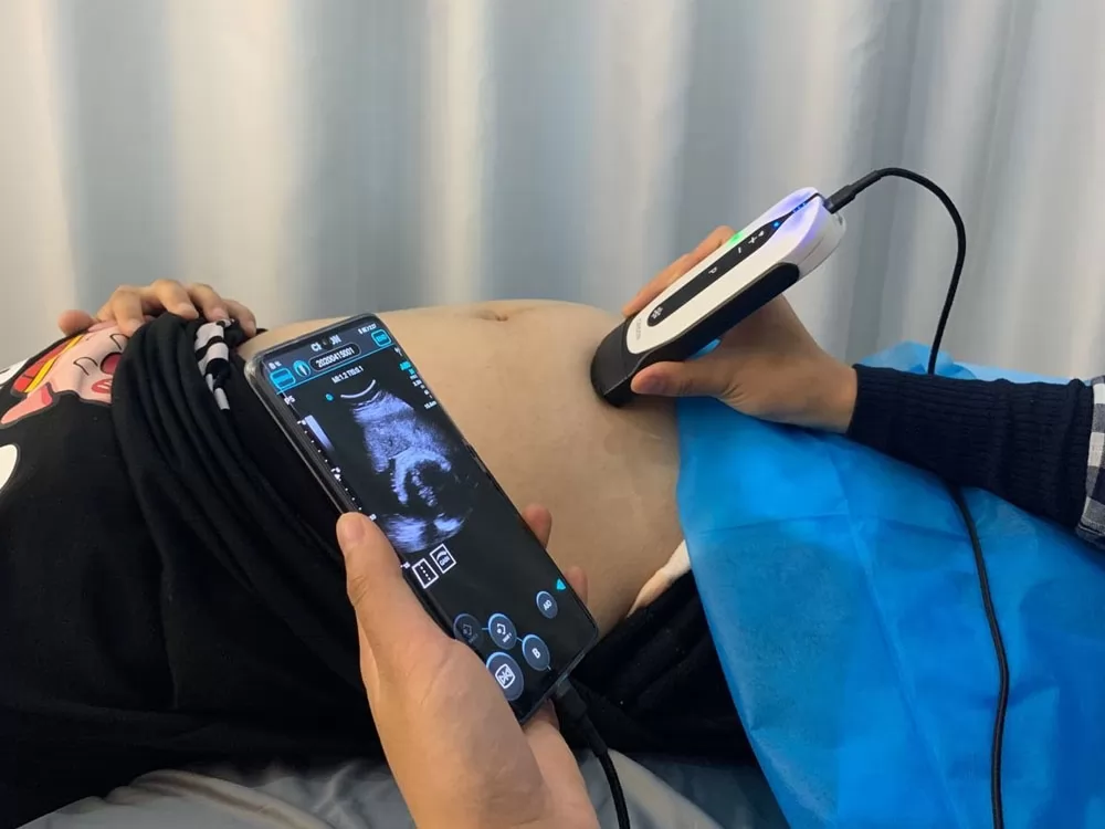 Designed for simplicity, speed and precision, Chison is the premier solution for our point-of-care ultrasound systems.