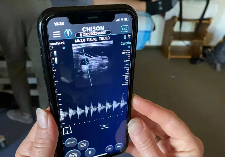 Chison uses advanced imaging technology and multiple transducers. We like to think of this portable ultrasound as breaking the barrier between black and white and Doppler ultrasound diagnostic systems. It comes with optional power Doppler and PW Doppler to provide additional versatility.