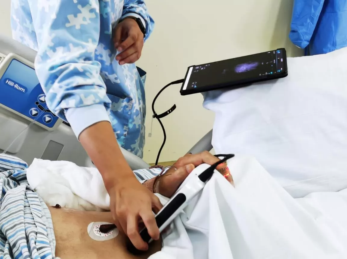 A physician or practitioner uses a handheld probe or transducer to transmit sound waves into the blood vessels. The sound waves bounce off the blood cells as they pass through the arteries.