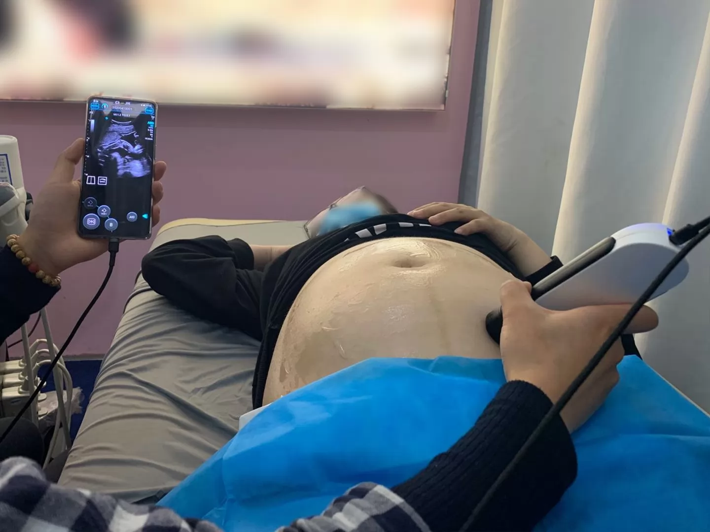 Biparietal diameter (BPD), head circumference (HC), abdominal circumference (AC), and femoral length (FL) are measurements taken in the 2nd and 3rd months of pregnancy to estimate gestational age and body weight.