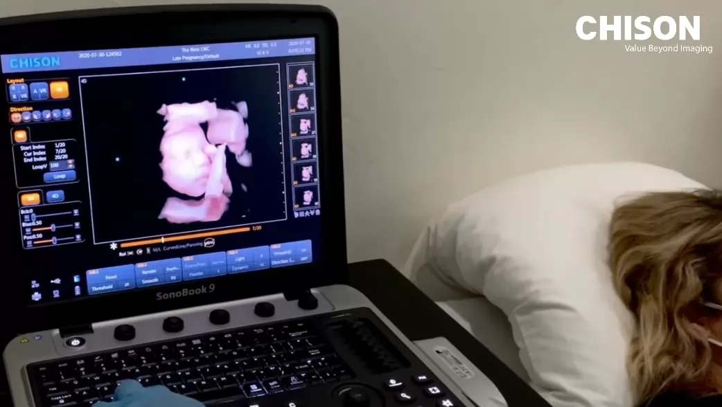 The machine is capable of creating real-time images, which means you can see your baby.