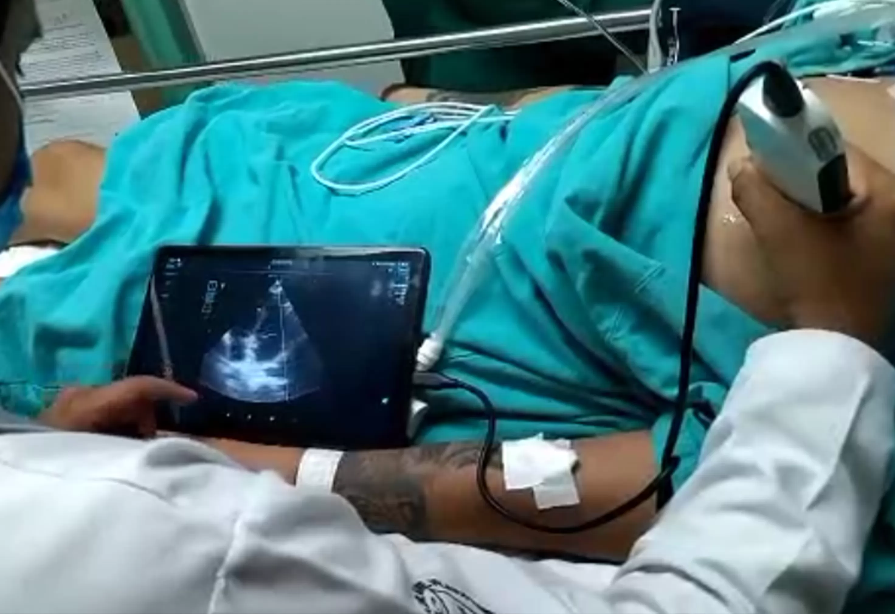 The ultrasound machine combines optimal ergonomics, ease of use and attractive design.