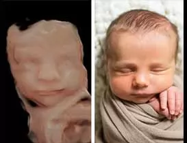 One of the main advantages of a portable 3D ultrasound machine is its ability to be used in a variety of settings, such as in a hospital, clinic, or even in remote or hard-to-reach locations. T