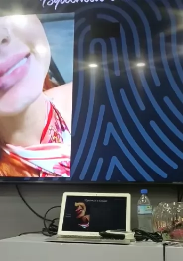 handheld ultrasound is used to assess the location and extent of scar tissue. This is important for planning surgical revision procedures, 