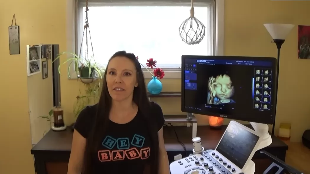 One of the primary benefits of the obstetric ultrasound machine is that it is non-invasive and does not expose the mother or fetus to harmful radiation. 